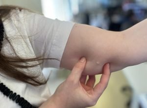 Implante contraceptivo cresce 118% no SUS do Paraná em 2025