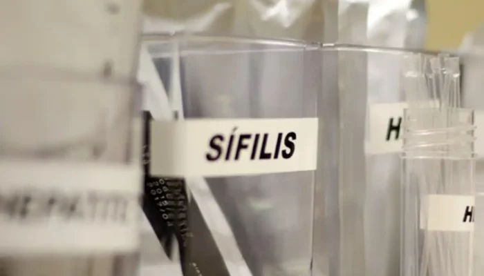 Sífilis cresce rapidamente no Brasil, especialmente entre gestantes