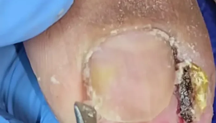 lv_0_20260413164805-1476x1536