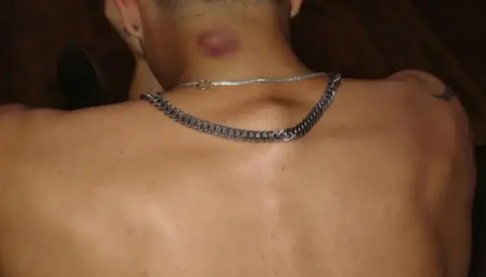 retouch_2026012822510748